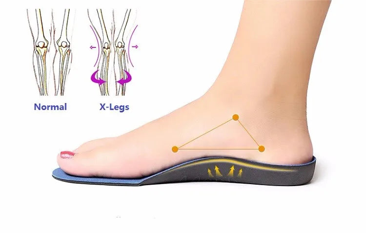 Flat Foot Arch Support Orthopedic Insoles Men Women Shoes Pad Sweat Shock Absorption Breathable Sports Insoles Orthotic Devices
